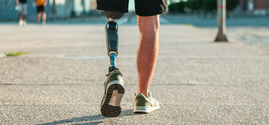 patient experiencing Phantom Limb Syndrome and in need of the neuropathy treatment protocol at Monumental Health and Wellness in Colville
