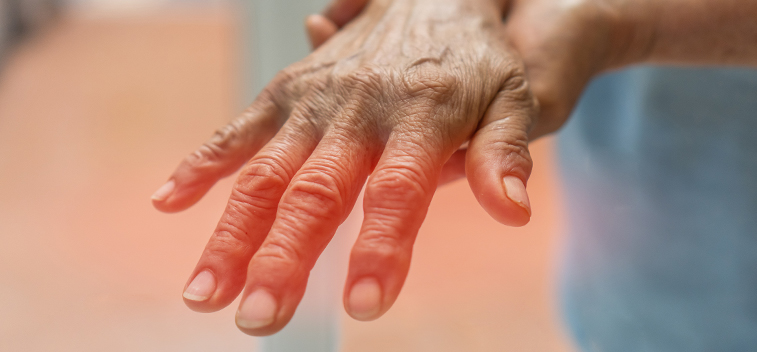 patient experiencing Stabbing & Burning Pain and in need of the neuropathy treatment protocol at Monumental Health and Wellness in Colville